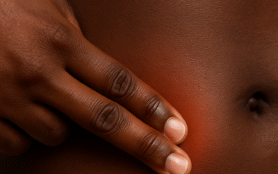 L&rsquo;appendicite, une urgence médicale fréquente